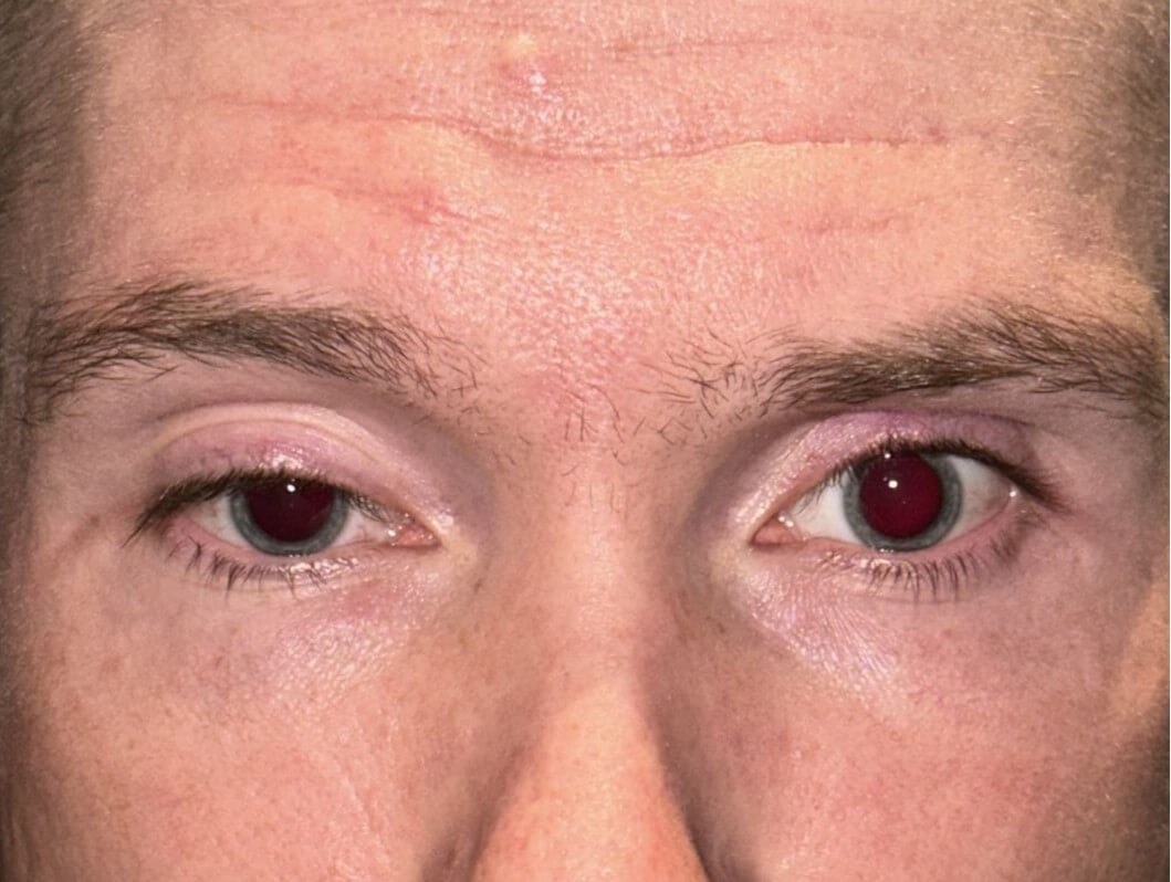 Before Image