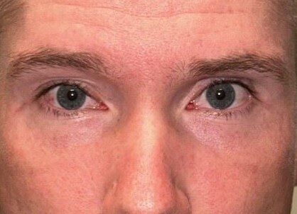 After Image