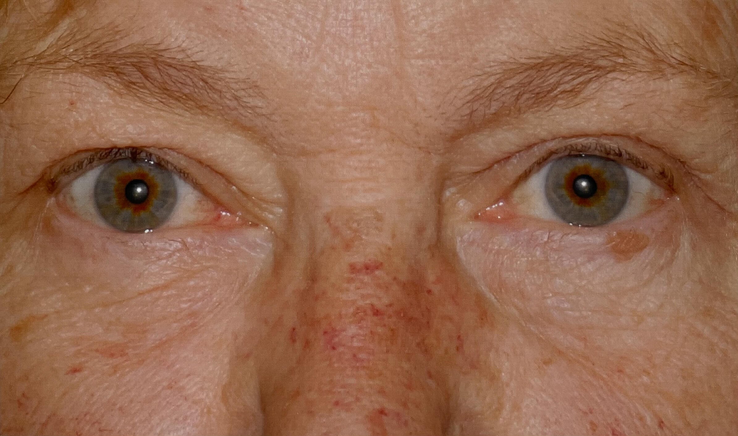 After Image