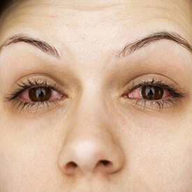Eye Infections